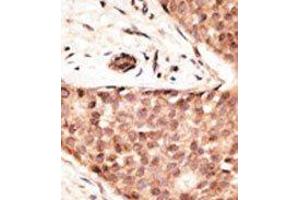Image no. 2 for anti-Caudal Type Homeobox 2 (CDX2) (N-Term) antibody (ABIN358610)