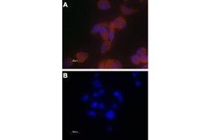 Immunocytochemistry (ICC) image for anti-Transient Receptor Potential Cation Channel, Subfamily V, Member 6 (TRPV6) (AA 712-725), (Intracellular) antibody (ABIN7043857)