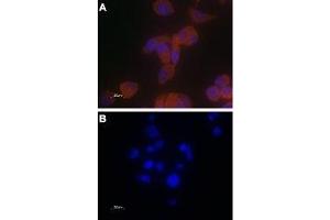Expression of TRPV6 in PC-3 cells - Immunocytochemical staining of paraformaldehyde-fixed PC-3 cells with Anti-TRPV6 Antibody (ABIN7043857, ABIN7043998 and ABIN7043999), (1:100) followed by goat anti-rabbit-AlexaFluor-555 secondary antibody (A) or with a mixture of Anti-TRPV6 Antibody and TRPV6 peptide antigen (1:20) (B). (TRPV6 抗体  (C-Term, Intracellular))