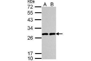 WB Image Sample (30 ug of whole cell lysate) A: A549 B: H1299 12% SDS PAGE antibody diluted at 1:5000 (UCHL1 抗体  (C-Term))