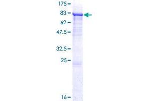 P4HA2 Protein (AA 1-533) (GST tag)