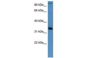 HADH antibody used at 0. (HADH 抗体  (Middle Region))