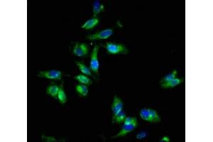 Immunofluorescence staining of Hela cells with ABIN7152021 at 1:133, counter-stained with DAPI. (EPOR 抗体  (AA 320-506))