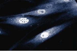Immunofluorescent staining of human fibroblast cells.