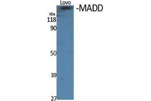 Western Blot (WB) analysis of specific cells using MADD Polyclonal Antibody. (MADD 抗体  (Internal Region))