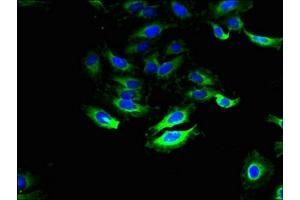 Immunofluorescence (IF) image for anti-Solute Carrier Family 28 (Sodium-Coupled Nucleoside Transporter), Member 1 (SLC28A1) (AA 1-80) antibody (ABIN7170032)