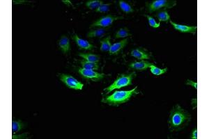 Immunofluorescent analysis of Hela cells using ABIN7170032 at dilution of 1:100 and Alexa Fluor 488-congugated AffiniPure Goat Anti-Rabbit IgG(H+L) (SLC28A1 抗体  (AA 1-80))