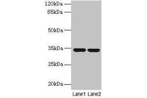Western blot All lanes: MRPL19 antibody at 2 μg/mL Lane 1: MCF-7 whole cell lysate Lane 2: Mouse liver tissue Secondary Goat polyclonal to rabbit IgG at 1/10000 dilution Predicted band size: 34 kDa Observed band size: 34 kDa (MRPL19 抗体  (AA 1-292))
