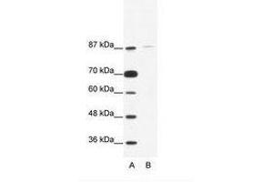 Image no. 1 for anti-TATA Box Binding Protein (TBP)-Associated Factor, RNA Polymerase I, C, 110kDa (TAF1C) (C-Term) antibody (ABIN203252) (TAF1C 抗体  (C-Term))