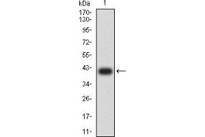 Western blot analysis using KDR mAb against human KDR (AA: 1225-1356) recombinant protein.