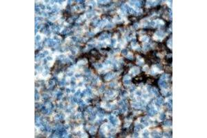 Immunohistochemical analysis of CMTM8 staining in human tonsil formalin fixed paraffin embedded tissue section.