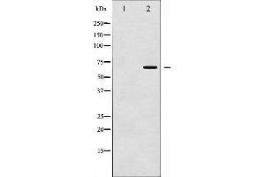 Western blot analysis of Chk2 phosphorylation expression in Jurkat whole cell lysates,The lane on the left is treated with the antigen-specific peptide. (CHEK2 抗体  (pThr387))