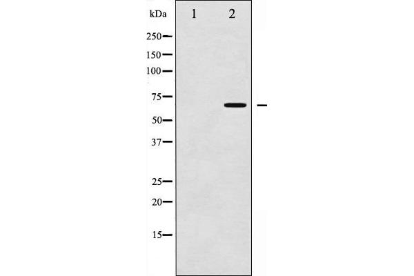 CHEK2 Antikörper  (pThr387)