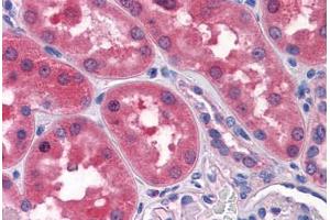 Human Kidney: Formalin-Fixed, Paraffin-Embedded (FFPE) (TWIST2 抗体  (AA 1-161))
