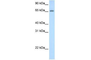 ADAT1 antibody used at 0. (ADAT1 抗体  (C-Term))