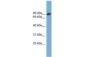 WB Suggested Anti-APBB1IP Antibody Titration: 0. (Amyloid beta (A4) Precursor Protein-Binding, Family B, Member 1 Interacting Protein (APBB1IP) (N-Term) 抗体)