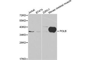 Western blot analysis of extracts of various cell lines, using POLB antibody (ABIN5970839) at 1/1000 dilution.