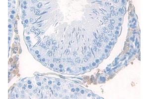 DAB staining on IHC-P; Samples: Rat Testis Tissue (Mucosae Associated Epithelia Chemokine (AA 29-131) 抗体)