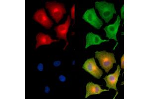 ABIN6260967 and ABIN6279315 staining  cells by IF/ICC. (COPG 抗体  (C-Term))