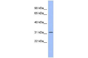 WB Suggested Anti-SPIB Antibody Titration:  0. (SPIB 抗体  (Middle Region))