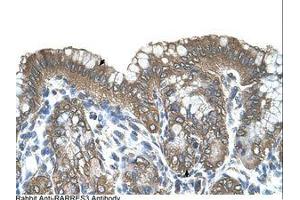 Image no. 1 for anti-Retinoic Acid Receptor Responder (Tazarotene Induced) 3 (RARRES3) (AA 51-100) antibody (ABIN321114) (RARRES3 抗体  (AA 51-100))
