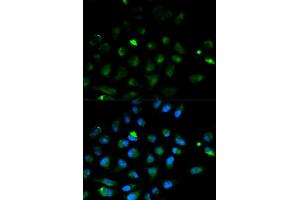 Immunofluorescence analysis of HeLa cell using PRF1 antibody. (Perforin 1 抗体)