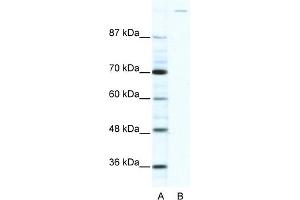 WB Suggested Anti-GLI1 Antibody Titration:  2. (GLI1 抗体  (C-Term))