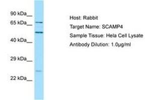 Image no. 1 for anti-Secretory Carrier Membrane Protein 4 (SCAMP4) (C-Term) antibody (ABIN6750133) (SCAMP4 抗体  (C-Term))