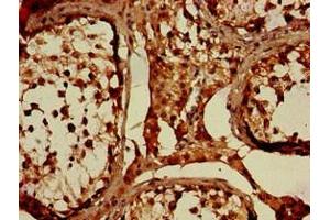Immunohistochemistry of paraffin-embedded human testis tissue using ABIN7169222 at dilution of 1:100 (WNK1 抗体  (AA 1-207))