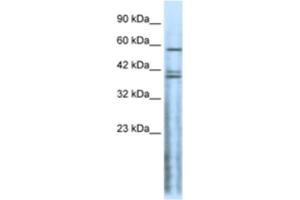 Western Blotting (WB) image for anti-Cholinergic Receptor, Nicotinic, delta (Muscle) (CHRND) antibody (ABIN2463735) (CHRND 抗体)