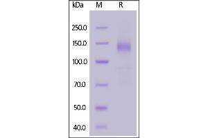 SARS-CoV-2 S1 protein, Fc Tag on  under reducing (R) condition. (SARS-CoV-2 Spike S1 Protein (B.1.351 - beta) (Fc Tag))