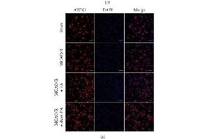 ABIN1 expression in the peri-infarct area at different time points. (TNIP1 抗体)