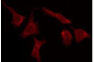 Immunofluorescence (fixed cells) (IF/ICC) image for anti-Olfactory Receptor, Family 51, Subfamily E, Member 1 (OR51E1) (C-Term) antibody (ABIN6258881)