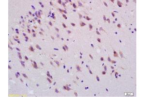 Formalin-fixed and paraffin embedded rat brain labeled with Anti-Smoothened/SMO Polyclonal Antibody, Unconjugated  at 1:200, followed by conjugation to the secondary antibody and DAB staining (SMO 抗体  (AA 551-650))