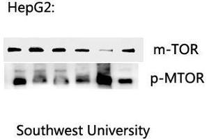 Western Blot (WB) analysis: Please contact us for more details. (MTOR 抗体  (pSer2448))