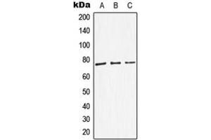 Western blot analysis of Dopamine beta Hydroxylase expression in HEK293T (A), SP2/0 (B), NIH3T3 (C) whole cell lysates. (DBH 抗体  (Center))