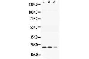 Western blot analysis of Adenylate Kinase 1 expression in rat skeletal muscle extract ( Lane 1), mouse cardiac muscle  extract ( Lane 2) and COLO320 whole cell lysates ( Lane 3). (Adenylate Kinase 1 抗体  (C-Term))