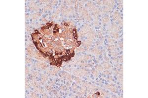 Immunohistochemistry of paraffin-embedded rat pancreas using  antibody (ABIN6131192, ABIN6137264, ABIN6137265 and ABIN6215207) at dilution of 1:100 (40x lens). (ATG5 抗体  (AA 28-275))