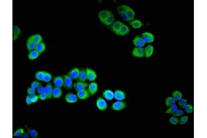 Immunofluorescent analysis of PC-3 cells using ABIN7166973 at dilution of 1:100 and Alexa Fluor 488-congugated AffiniPure Goat Anti-Rabbit IgG(H+L) (CHM 抗体  (AA 1-653))