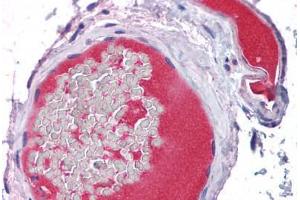 Vessels, Human: Formalin-Fixed, Paraffin-Embedded (FFPE) (PROC 抗体)