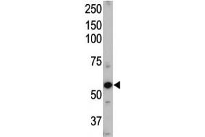 Western Blotting (WB) image for anti-Activin A Receptor Type II-Like 1 (ACVRL1) (AA 38-68) antibody (ABIN3029853)