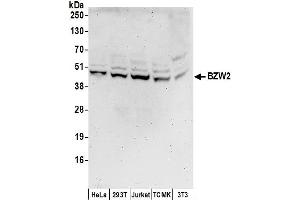 anti-Basic Leucine Zipper and W2 Domains 2 (BZW2) (AA 1-50) antibody