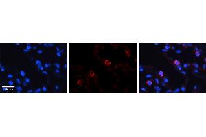 VARS antibody - middle region          Formalin Fixed Paraffin Embedded Tissue:  Human Lung Tissue    Observed Staining:  Cytoplasm of pneumocytes   Primary Antibody Concentration:  1:100    Other Working Concentrations:  1/600    Secondary Antibody:  Donkey anti-Rabbit-Cy3    Secondary Antibody Concentration:  1:200    Magnification:  20X    Exposure Time:  0. (VARS 抗体  (Middle Region))