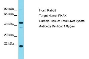Western Blotting (WB) image for anti-phosphorylated Adaptor For RNA Export (PHAX) (Middle Region) antibody (ABIN2790159)