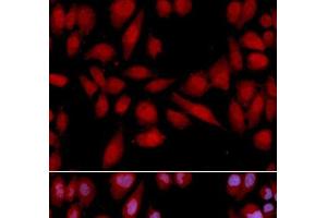 Immunofluorescence analysis of U2OS cells using PSMA2 Polyclonal Antibody (PSMA2 抗体)