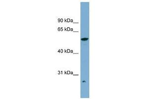 ALDH3A2 antibody used at 1 ug/ml to detect target protein. (ALDH3A2 抗体  (Middle Region))