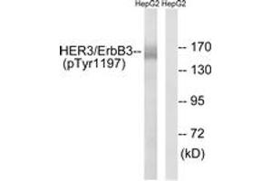 Western blot analysis of extracts from HepG2 cells , using HER3 (Phospho-Tyr1197) Antibody. (ERBB3 抗体  (pTyr1197))