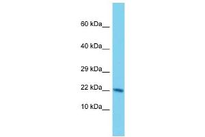 Western Blotting (WB) image for anti-Nudix (Nucleoside Diphosphate Linked Moiety X)-Type Motif 3 (NUDT3) (Middle Region) antibody (ABIN2791067)