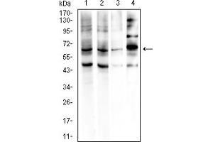 Western Blotting (WB) image for anti-Glypican 3 (GPC3) (AA 55-200) antibody (ABIN7193692)