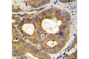 Immunohistochemistry (IHC) image for anti-Transient Receptor Potential Cation Channel, Subfamily M, Member 8 (TRPM8) (AA 69-98) antibody (ABIN3029241)